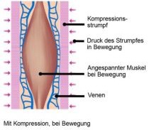Muskel-mit-Komp-bei-Bew
